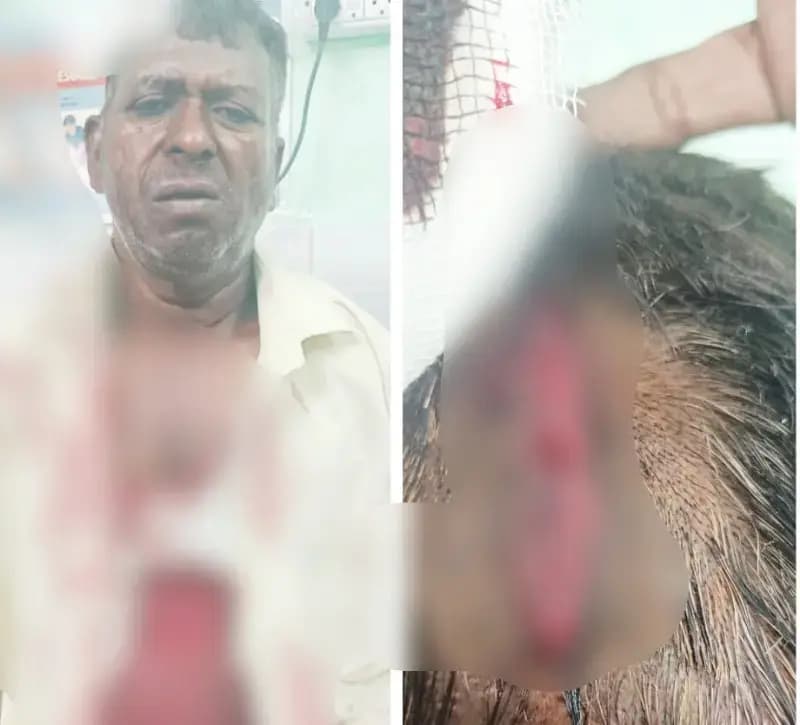 बेरी के पेड़ की छटाई को लेकर खूनी संघर्ष, दबंगों ने युवक पर किया जानलेवा हमला, हालत गंभीर