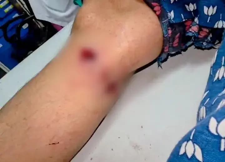 चिनहट में आधी रात खूनी संघर्ष, युवती ने जाल बिछाकर पड़ोसियों को बुलाया, फिर बरसाईं गोलियां 